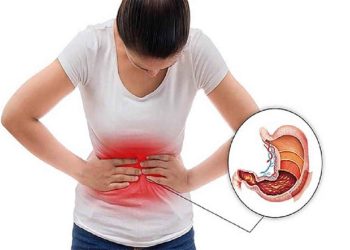 Bệnh đau dạ dày và những thông tin bạn cần biết