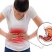 Bệnh đau dạ dày và những thông tin bạn cần biết