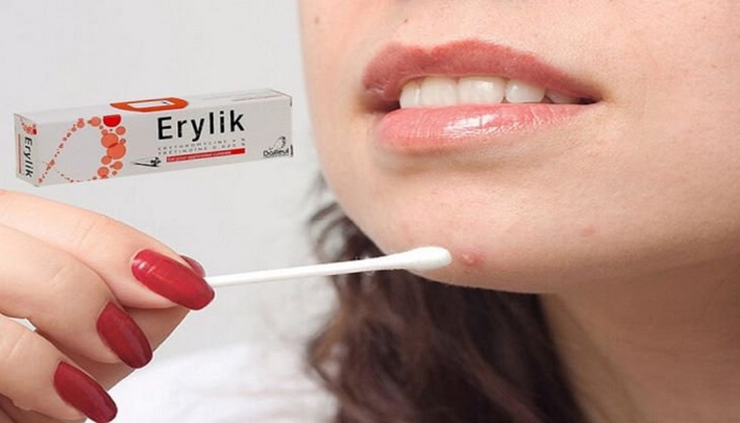 Tác dụng của Thuốc trị mụn Erylik