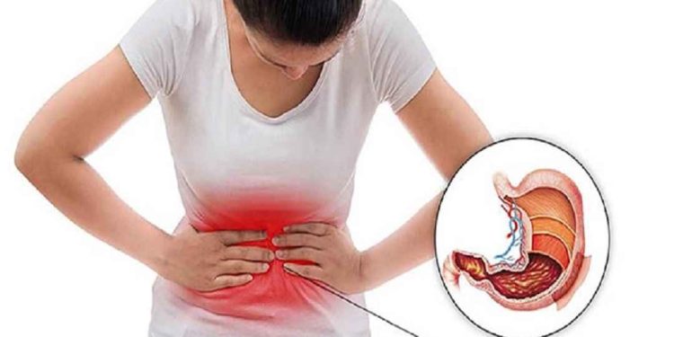 Bệnh đau dạ dày và những thông tin bạn cần biết